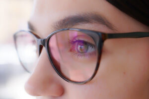 Novartis gibt US-Vertriebsrechte für Augenarzneien an Harrow ab