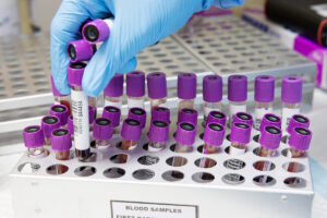 Fresenius-Chef bereitet Entflechtung von Fresenius und FMC vor