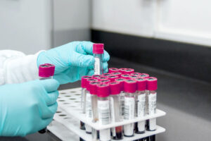 Synlab hält Dividende trotz Ende des Corona-Booms stabil