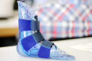 Prothesenhersteller Ottobock baut Ergebnis leicht aus